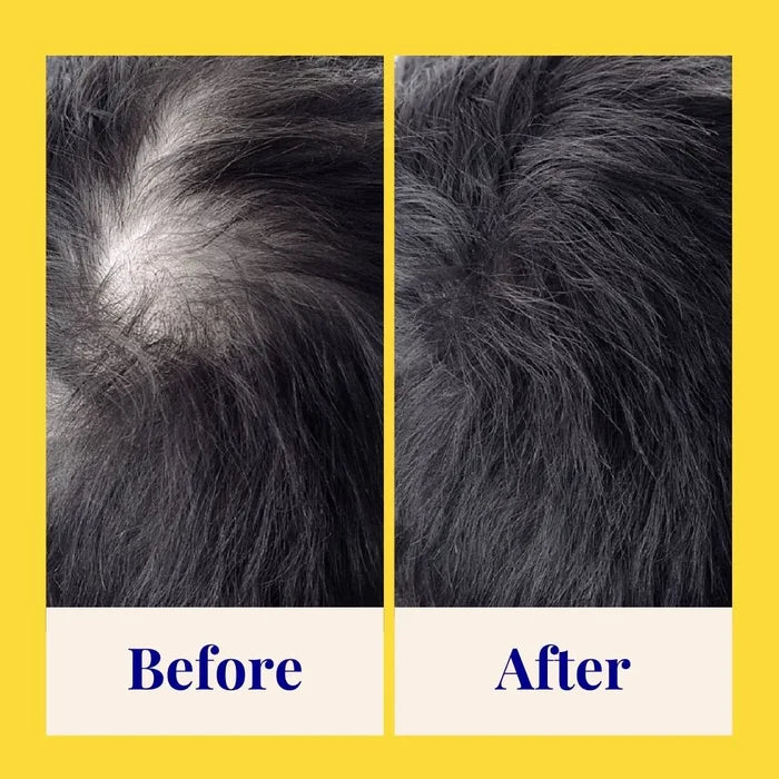 1 Year Supply - (320x Washes) Invigorating Shampoo For Thinning & Ageing Hair Bergamot, Biotin, Ginger & Ginseng