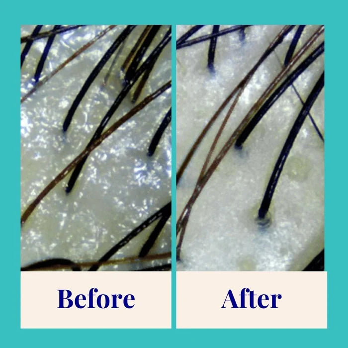 1 Year Supply (320x Washes) - Purifying Shampoo For Oily Scalp & Limp Hair Peppermint & Papaya Enzyme