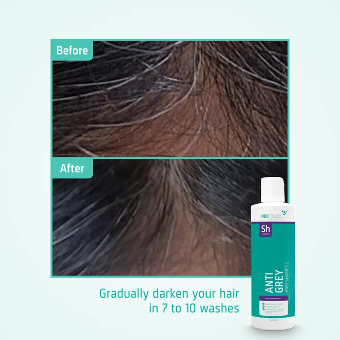 Anti Grey Hair Shampoo before after