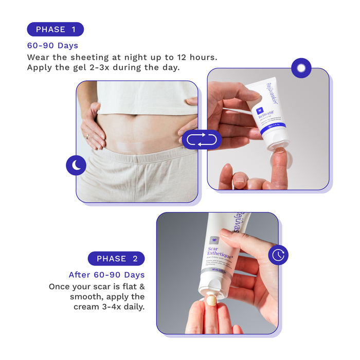 Step-by-step Complete C-Section Scar Regimen routine