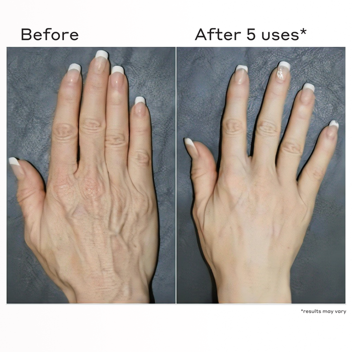 creme de la zen before and after hand shot from 5 days of use