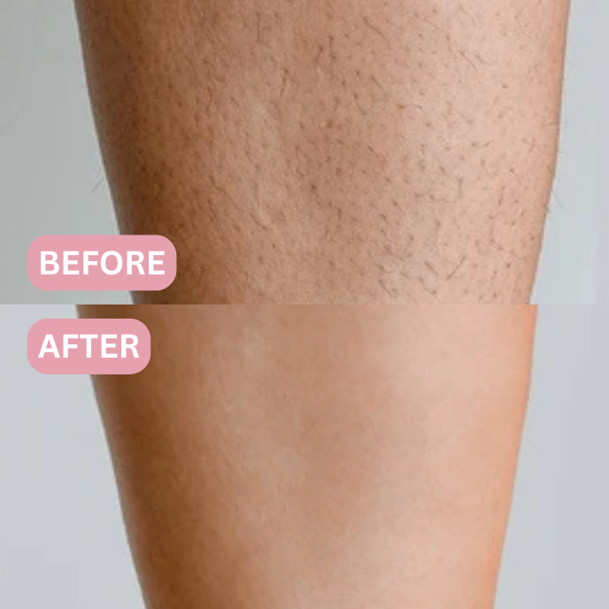 Lunea™ – 2-in-1 Women’s Body Shaver