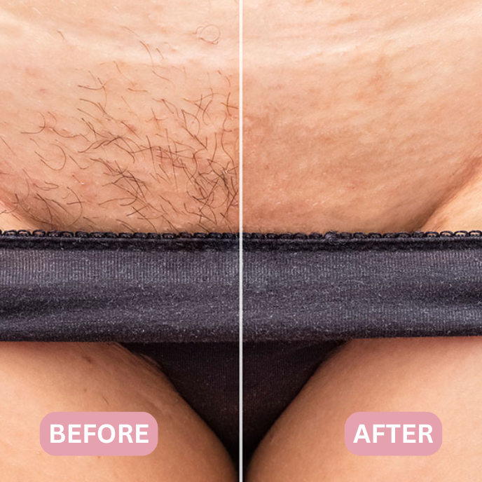 Lunea™ – 2-in-1 Women’s Body Shaver