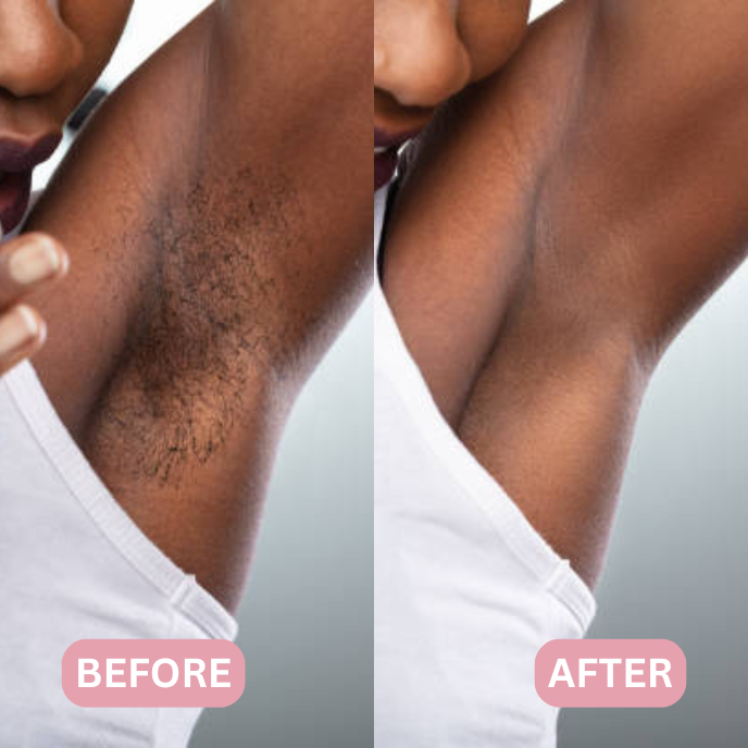 Lunea™ – 2-in-1 Women’s Body Shaver
