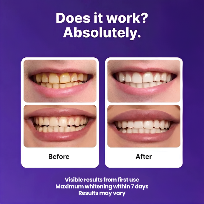 Lunea™ Teeth Whitening Strips