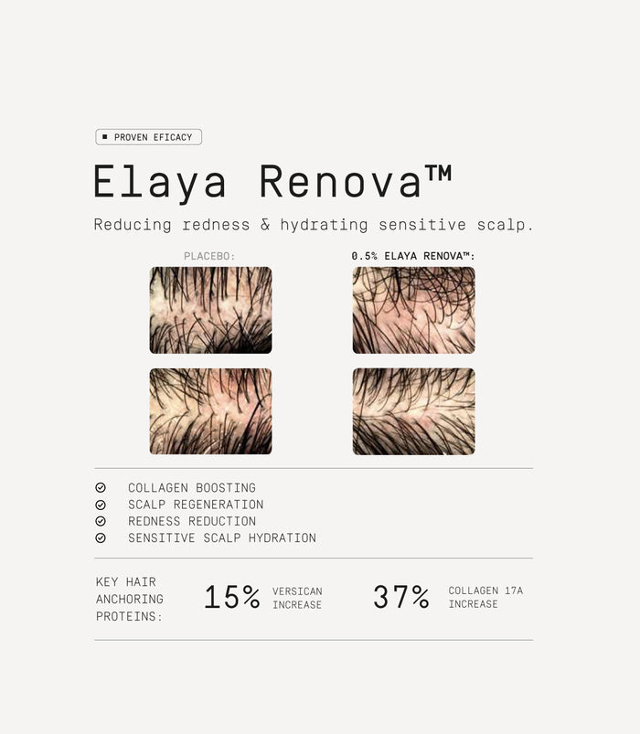 Scalp Activation Treatment
