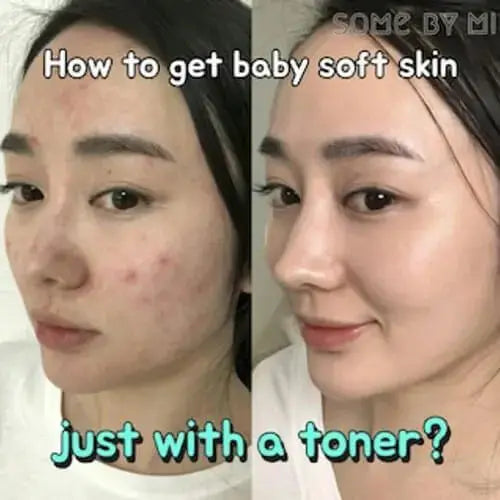 SOME BY MI AHA BHA PHA 30 Days Miracle Toner 150 ml - DOKAN
