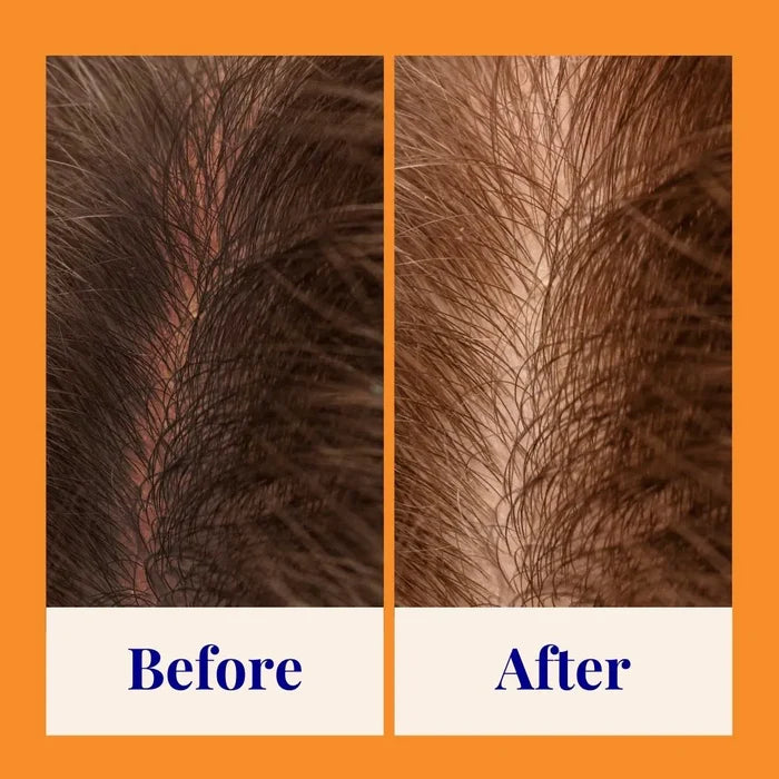 Starter Kit (140x Washes) - Strengthening Shampoo For Normal & Sensitive Scalps Grapefruit & Probiotics